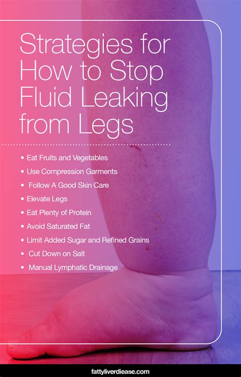 legs leaking fluid|Edema: Causes, Symptoms & Treatment